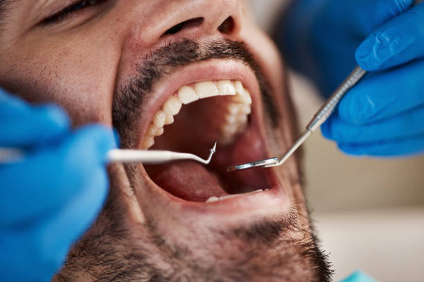 Best Pediatric Emergency Dentist in Casselton, ND